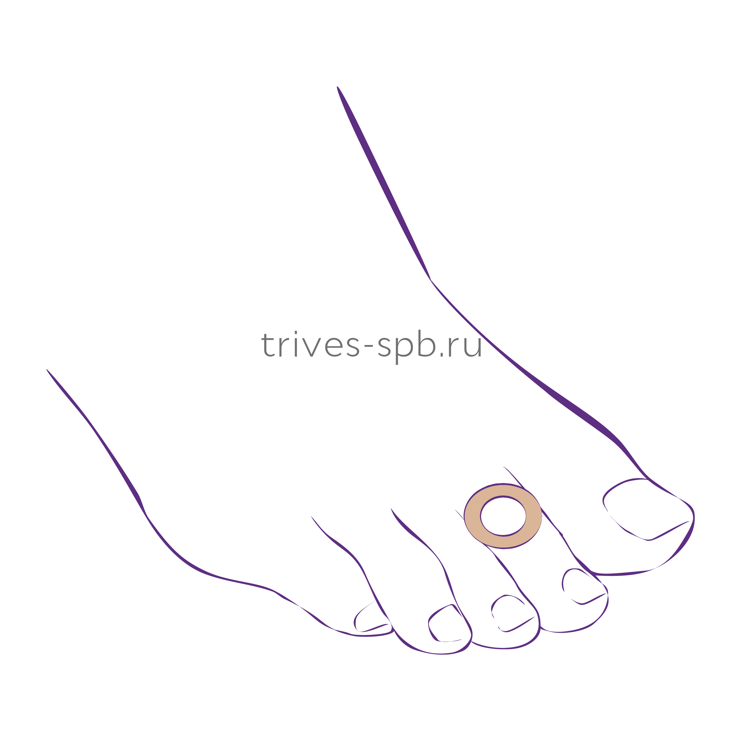 Протектор-кольцо с клеевым слоем СТ-63