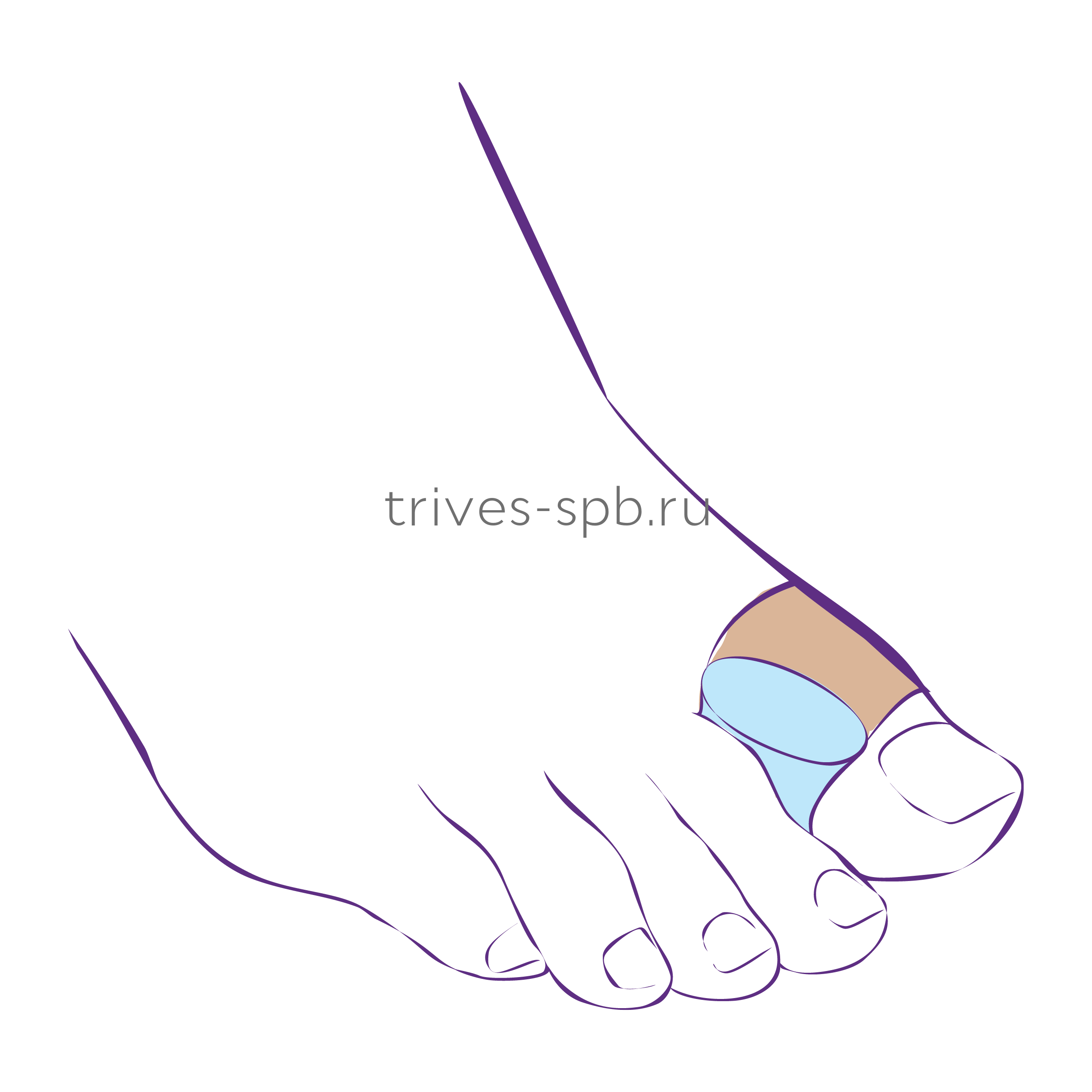 Перегородка межпальцевая увеличенной толщины на первый палец СТ-54.5